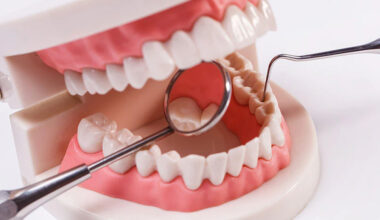 5 Benefits of Choosing Individualized Dental Treatment Plans in Maple Ridge