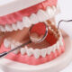 5 Benefits of Choosing Individualized Dental Treatment Plans in Maple Ridge