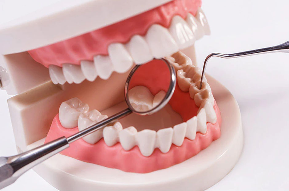 5 Benefits of Choosing Individualized Dental Treatment Plans in Maple Ridge