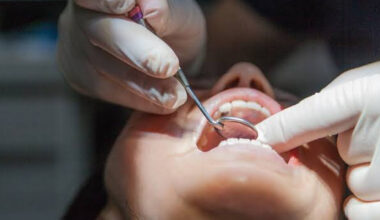 Comprehensive Oral Cancer Screening Services Provided by a Dentist in South Surrey