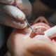 Comprehensive Oral Cancer Screening Services Provided by a Dentist in South Surrey