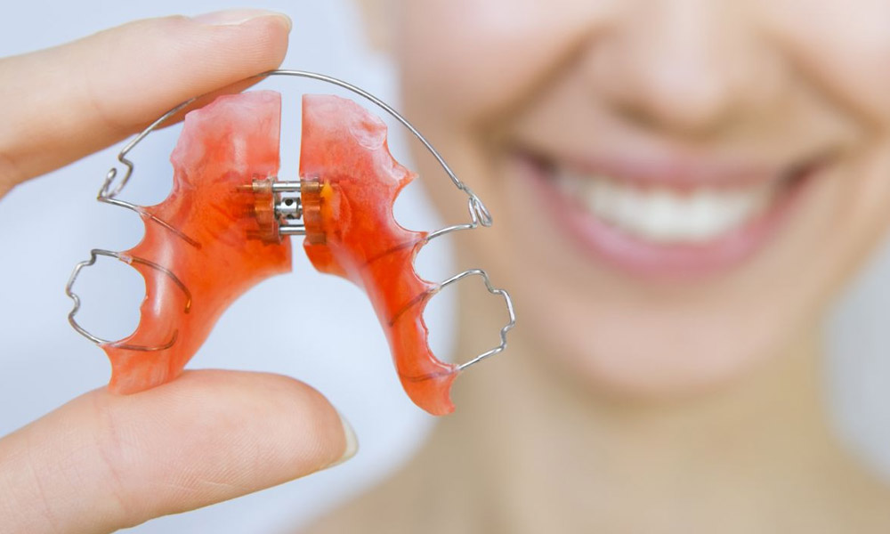 How Upper Jaw Expanders Help Correct Narrow Palates Early in South Riding
