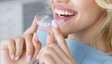What Orthodontists in Johns Creek Check Before Recommending Braces