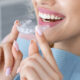 What Orthodontists in Johns Creek Check Before Recommending Braces