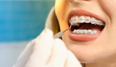 What To Expect During Your First Orthodontic Visit In South Surrey