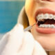 What To Expect During Your First Orthodontic Visit In South Surrey
