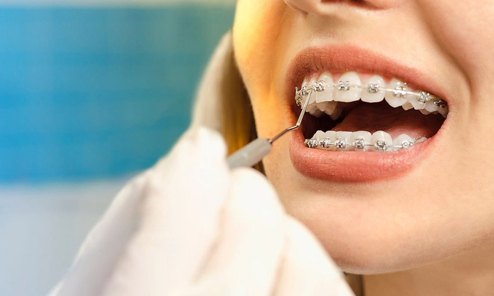 What To Expect During Your First Orthodontic Visit In South Surrey