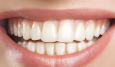 How Oral Surgeons Can Help With Severe Dental Issues 1