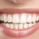 How Oral Surgeons Can Help With Severe Dental Issues 1