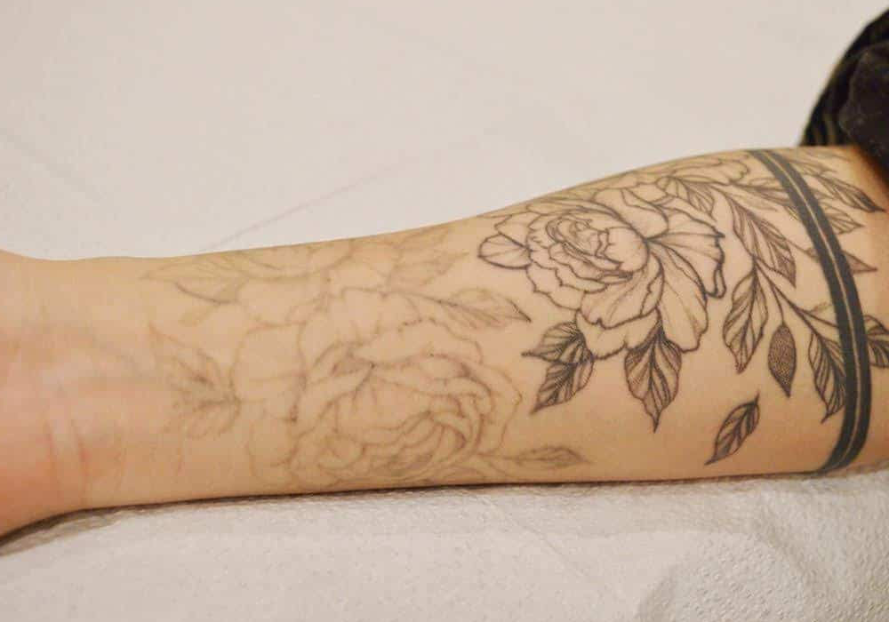 How to Fade a Tattoo for a Cover Up