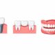 Tooth Replacement Options in South Tulsa
