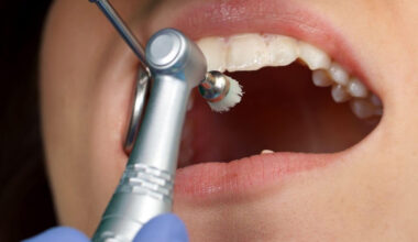 Urgent Oral Care