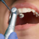 Urgent Oral Care