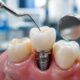Top Dental Implant Providers In Orlando 6 Practices To Compare